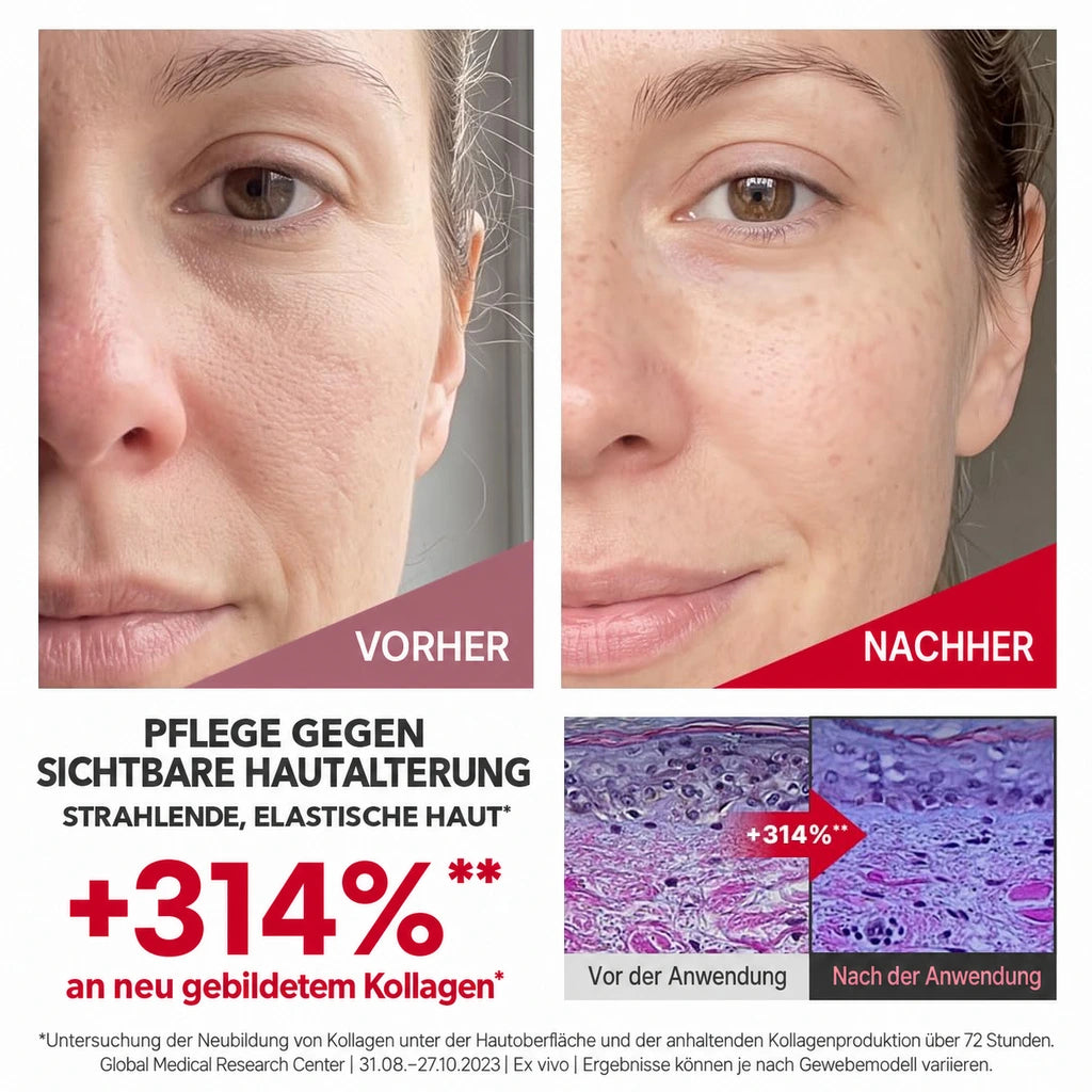 Madeca Cream Time Reverse Vorher Nachher, beispielhafte Darstellung